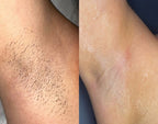 AMAZING INGROWN BUMP SCRUB