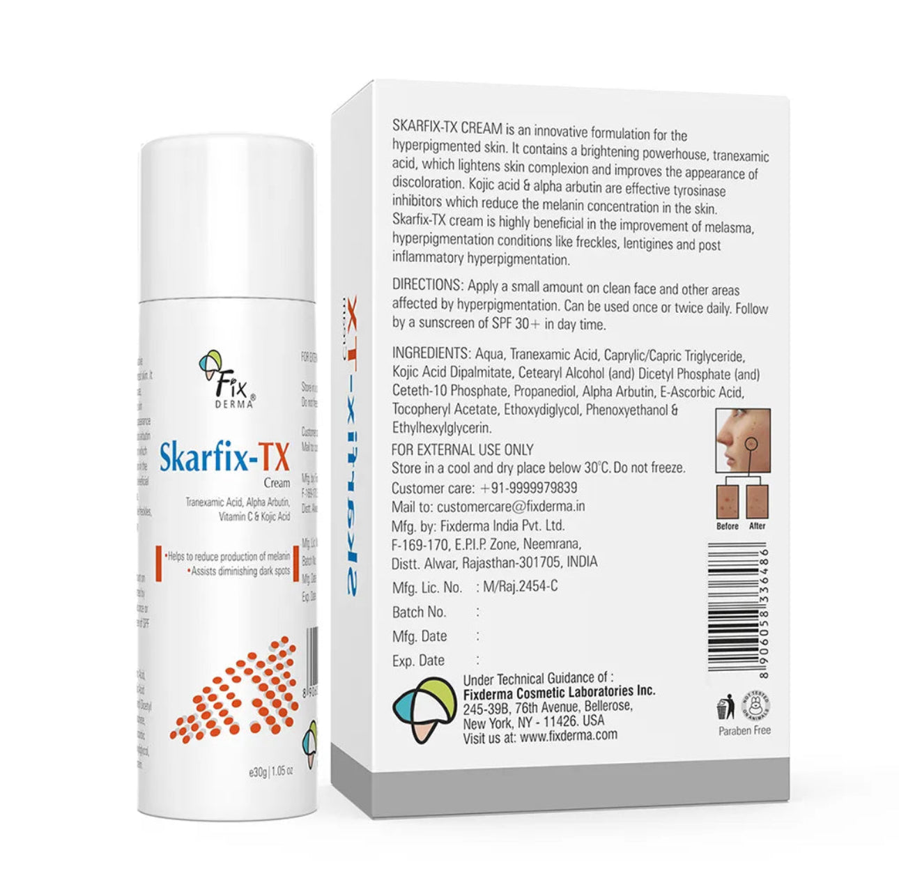 Skarfix-TX For Melasma Treatment | Tranexamic Acid, Vitamin C, Kojic Acid, Alpha Arbutin