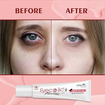 Eyecojic- Dark Circles Remover Gel | Under Eye Gel for Dark Circles | Enriched with Vitamin E- 15g